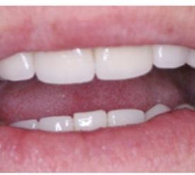 Espai Dental Rehabilitación oral integral 1