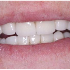 Espai Dental Rehabilitación oral integral 2